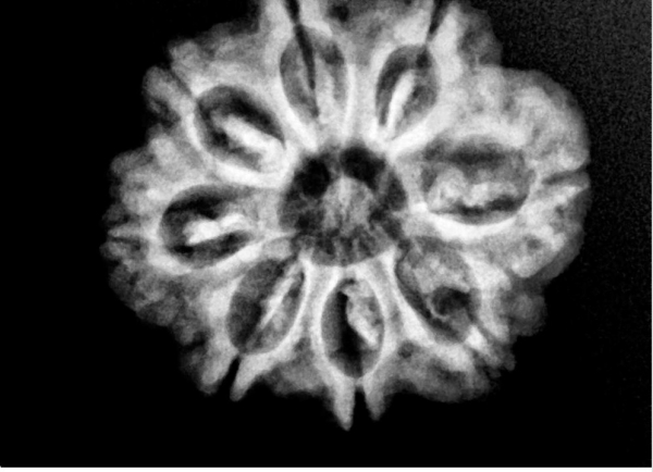 Digital X-Ray Scan